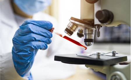 Scientist placing a blood sample onto a microscope slide
