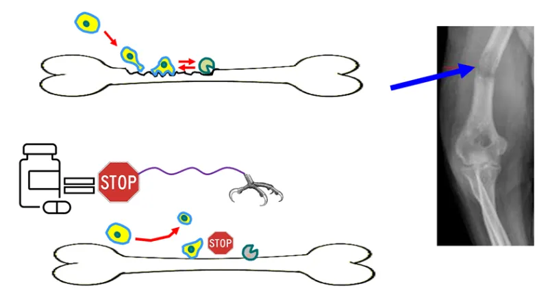 Scientific illustration showing cells interacting with bone tissue and causing damage that leads to a fracture, represented by an X-ray image. A second diagram shows a treatment approach blocking harmful cell activity and protecting the bone from further damage.